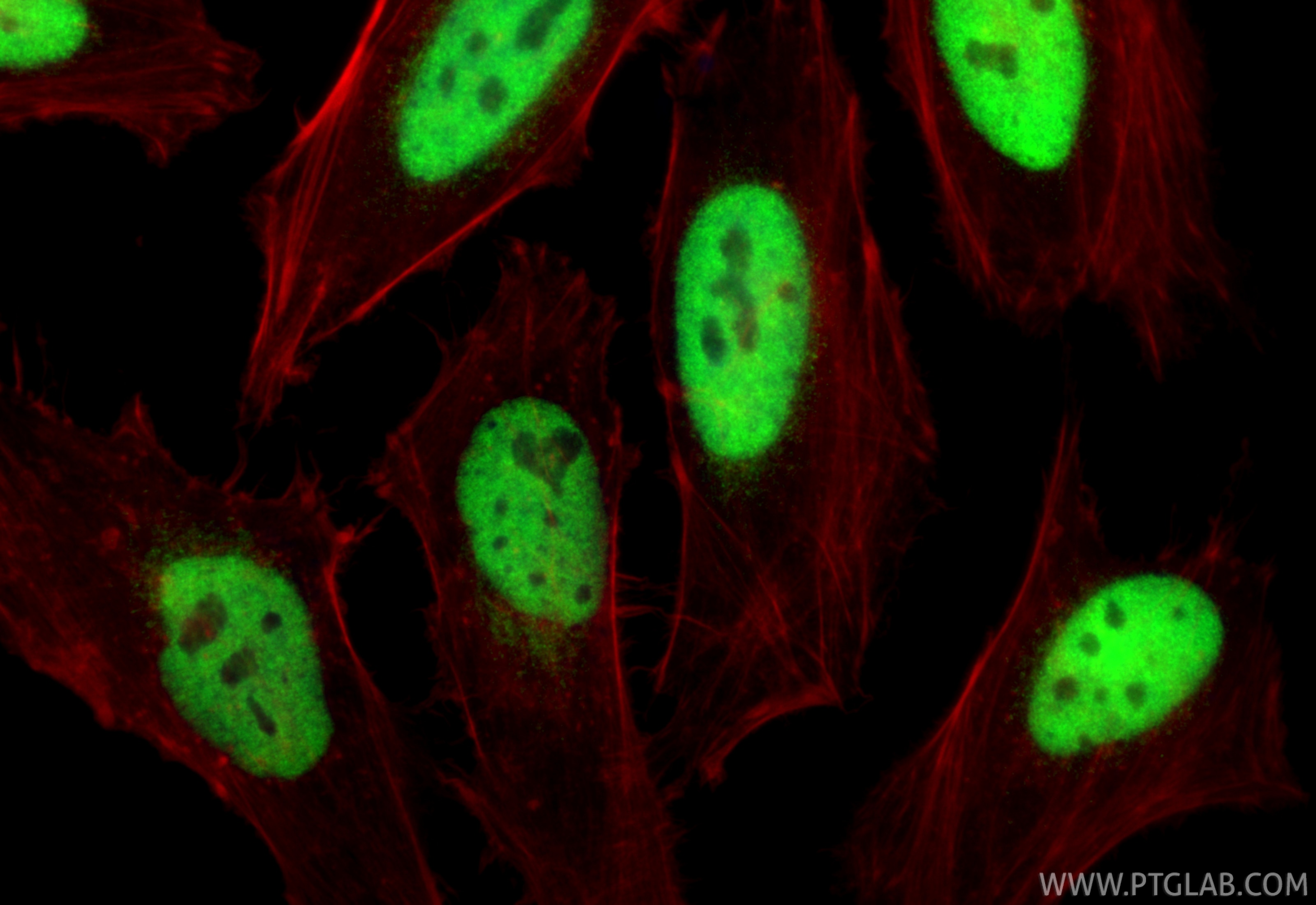 Immunofluorescence (IF) / fluorescent staining of HeLa cells using ATF1 Polyclonal antibody (11946-1-AP)