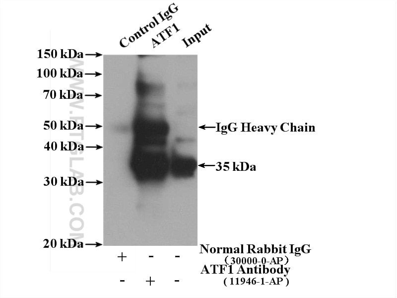Immunoprecipitation (IP) experiment of HeLa cells using ATF1 Polyclonal antibody (11946-1-AP)