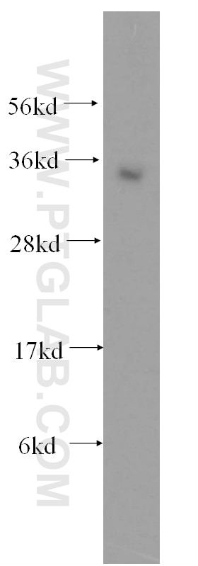 Western Blot (WB) analysis of A431 cells using ATF1 Polyclonal antibody (11946-1-AP)