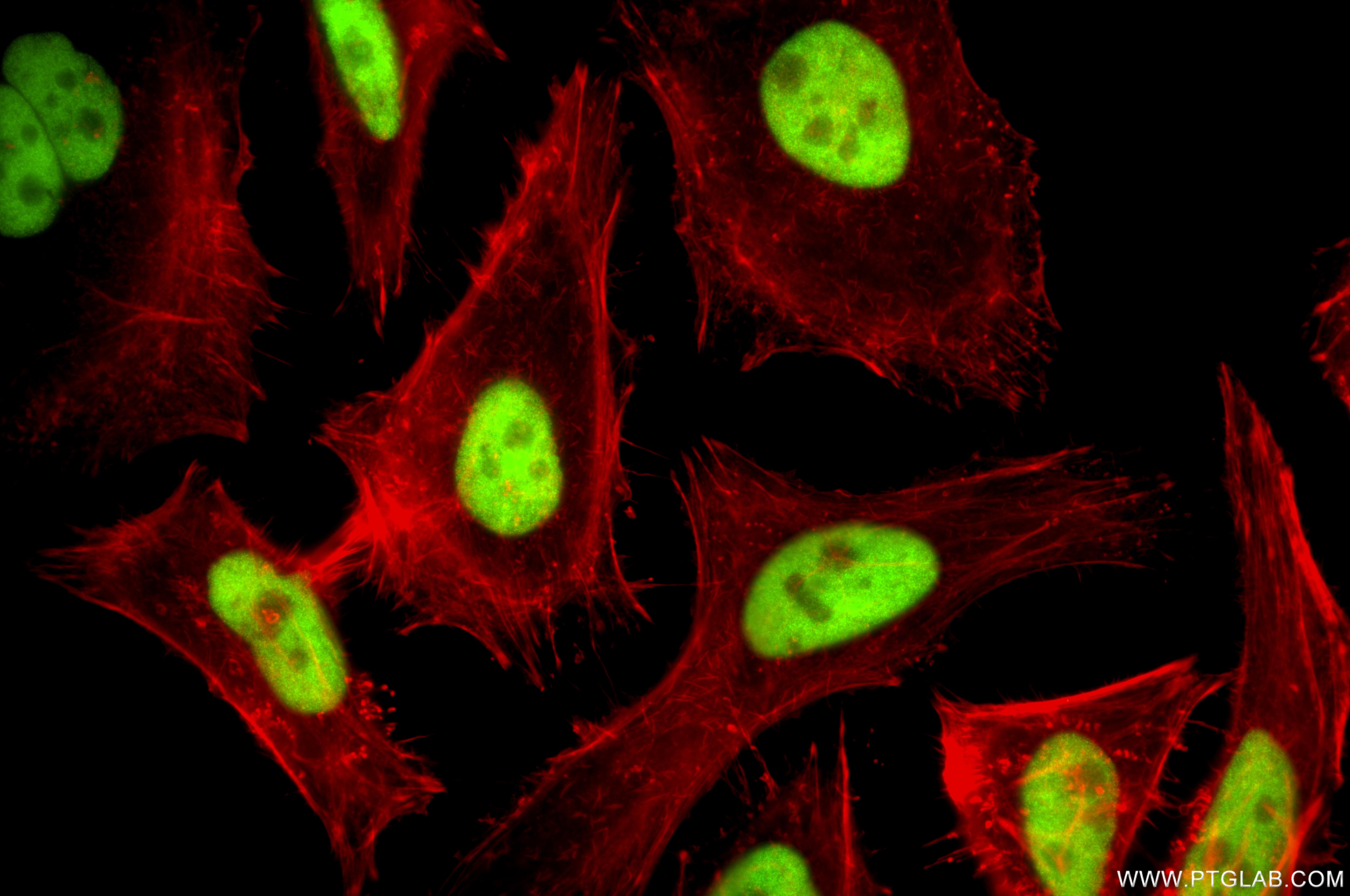 IF Staining of HeLa using 87421-1-RR (same clone as 87421-1-PBS) Immunofluorescence (IF) / fluorescent staining of HeLa cells using ATF1 Recombinant monoclonal antibody (87421-1-RR)