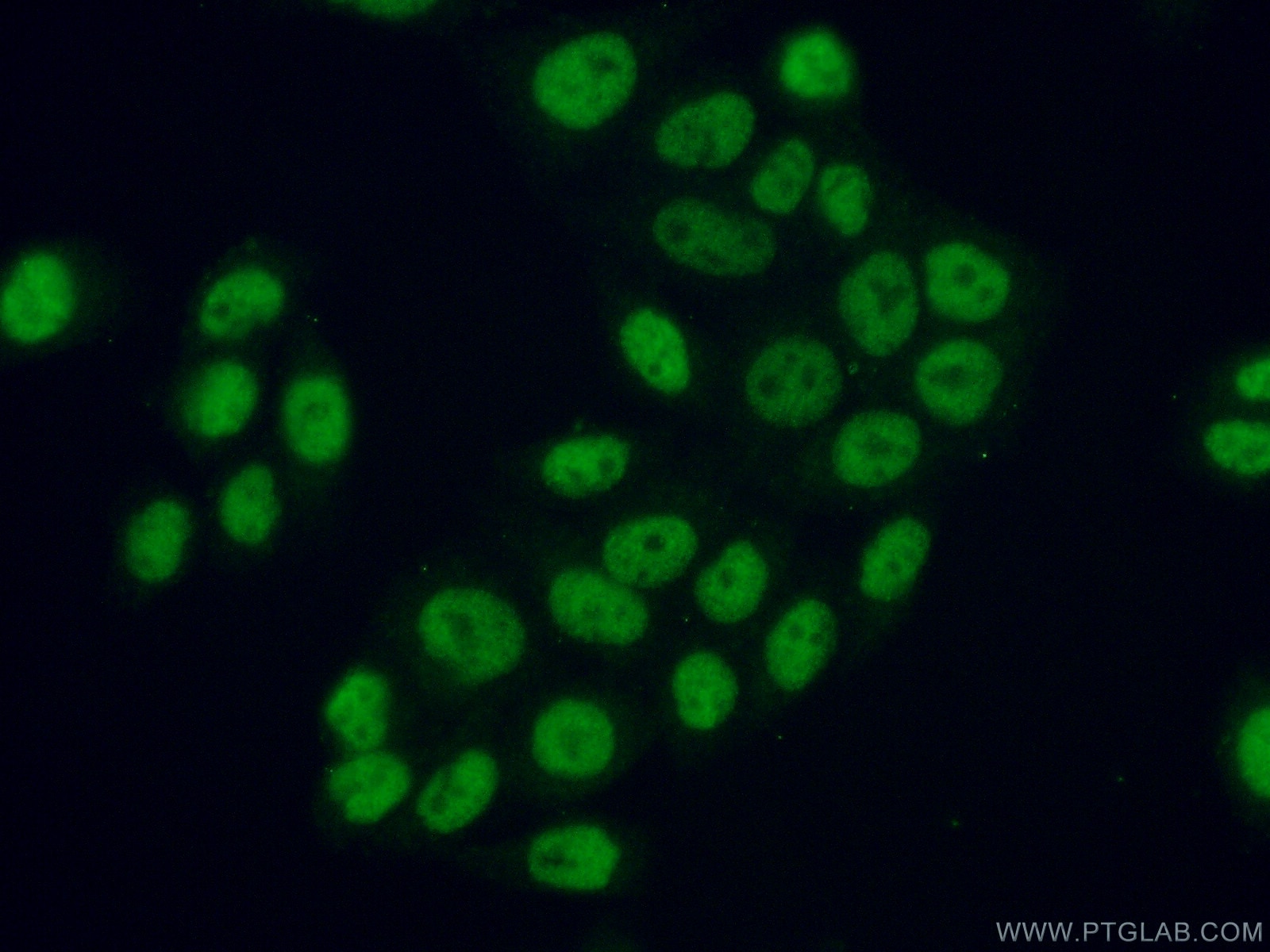 Immunofluorescence (IF) / fluorescent staining of HeLa cells using ATF2 Polyclonal antibody (11908-1-AP)