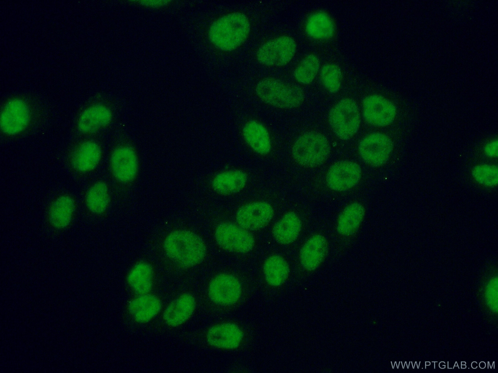 IF Staining of HeLa using 11908-1-AP