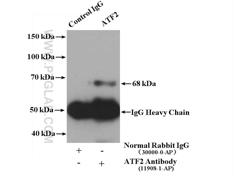 Immunoprecipitation (IP) experiment of mouse brain tissue using ATF2 Polyclonal antibody (11908-1-AP)