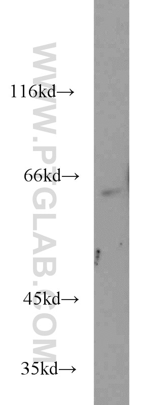 Western Blot (WB) analysis of mouse brain tissue using ATF2 Polyclonal antibody (11908-1-AP)