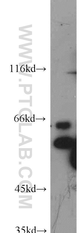 ATF2 Polyclonal antibody