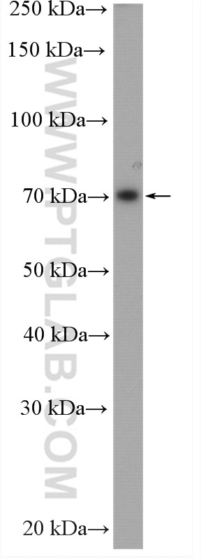 Western Blot (WB) analysis of LNCaP cells using ATF2-Specific Polyclonal antibody (14834-1-AP)