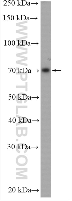 WB analysis of LNCaP using 14834-1-AP