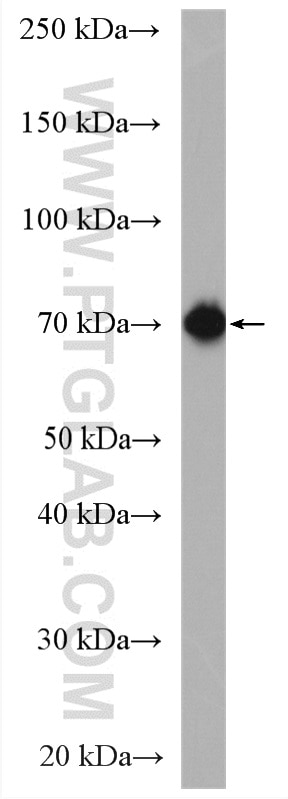 Western Blot (WB) analysis of C2C12 cells using ATF2-Specific Polyclonal antibody (14834-1-AP)
