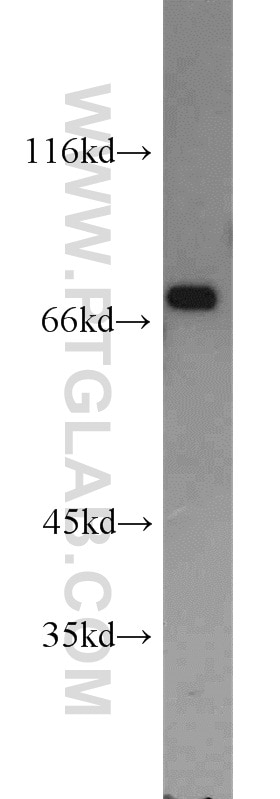 Western Blot (WB) analysis of HeLa cells using ATF2-Specific Polyclonal antibody (14834-1-AP)