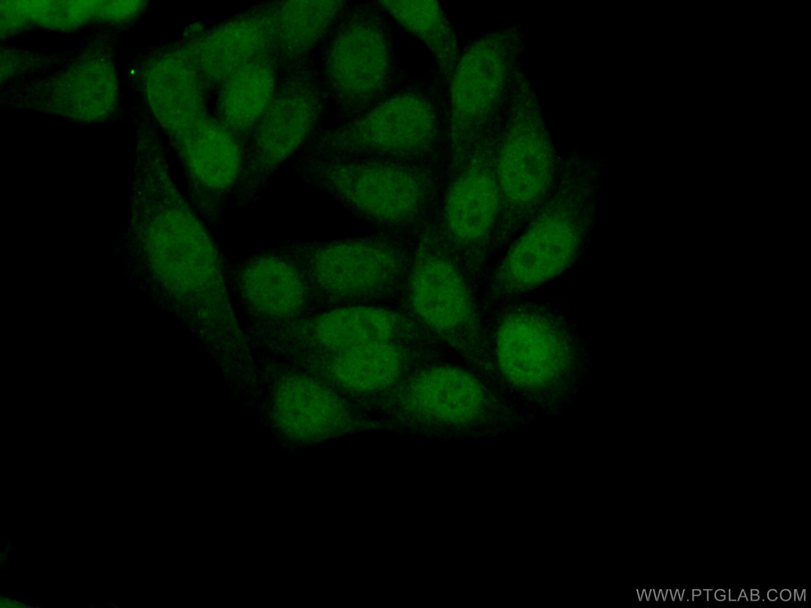 IF Staining of HepG2 using 10835-1-AP