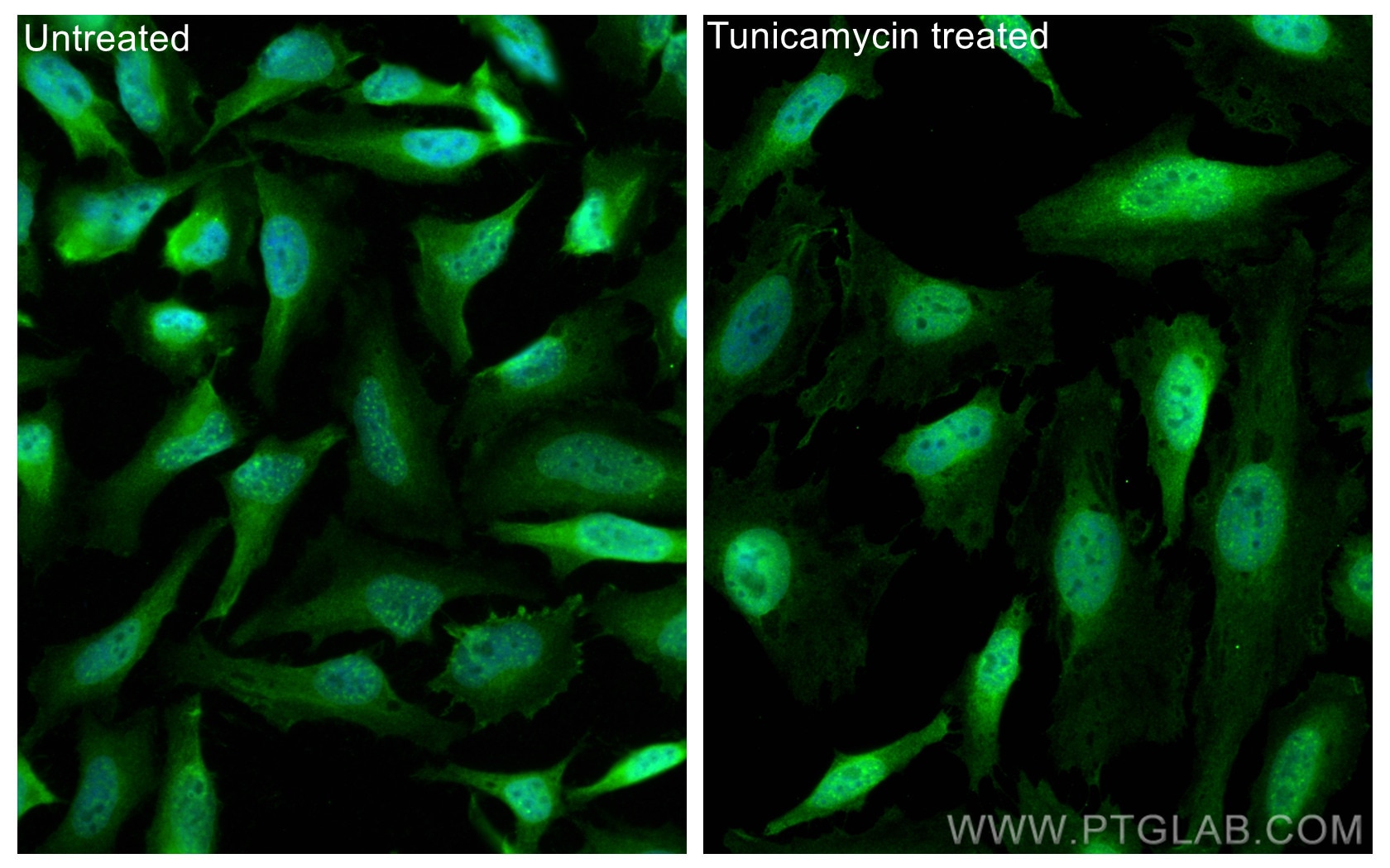 Immunofluorescence (IF) / fluorescent staining of HeLa cells using ATF4 Polyclonal antibody (10835-1-AP)