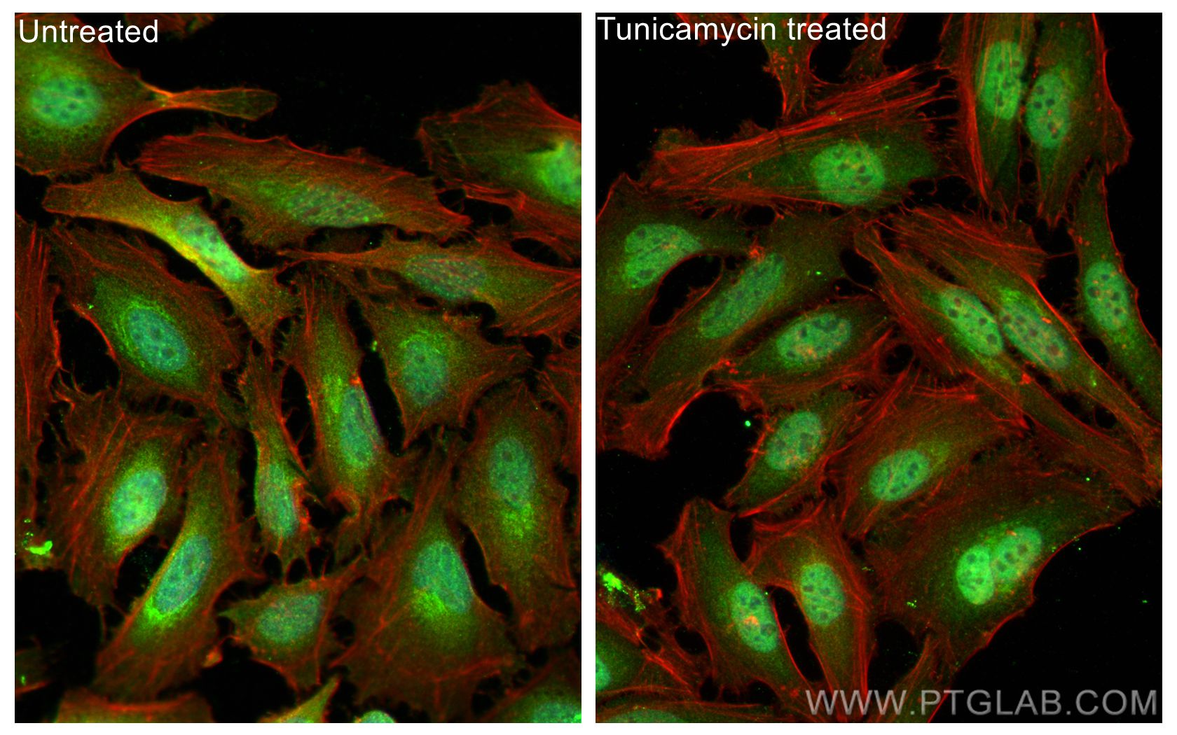 Immunofluorescence (IF) / fluorescent staining of HeLa cells using ATF4 Polyclonal antibody (10835-1-AP)