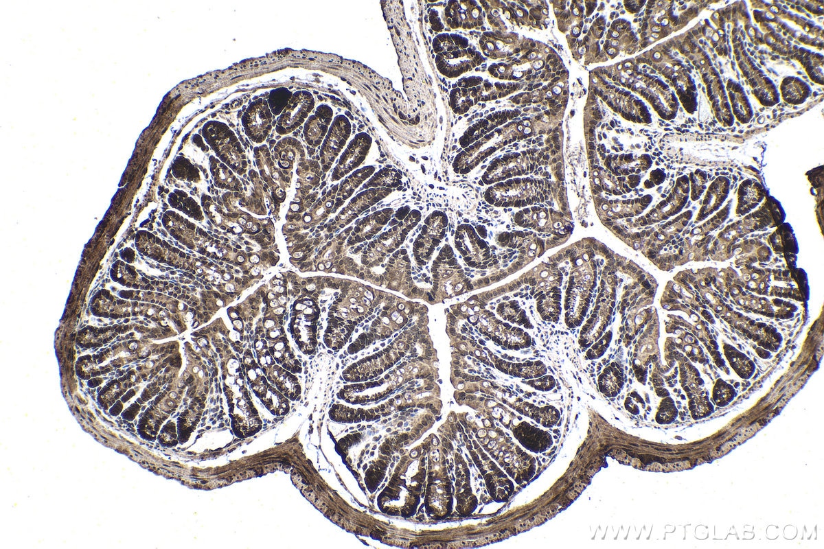 Immunohistochemistry (IHC) staining of mouse colon tissue using ATF4 Polyclonal antibody (10835-1-AP)