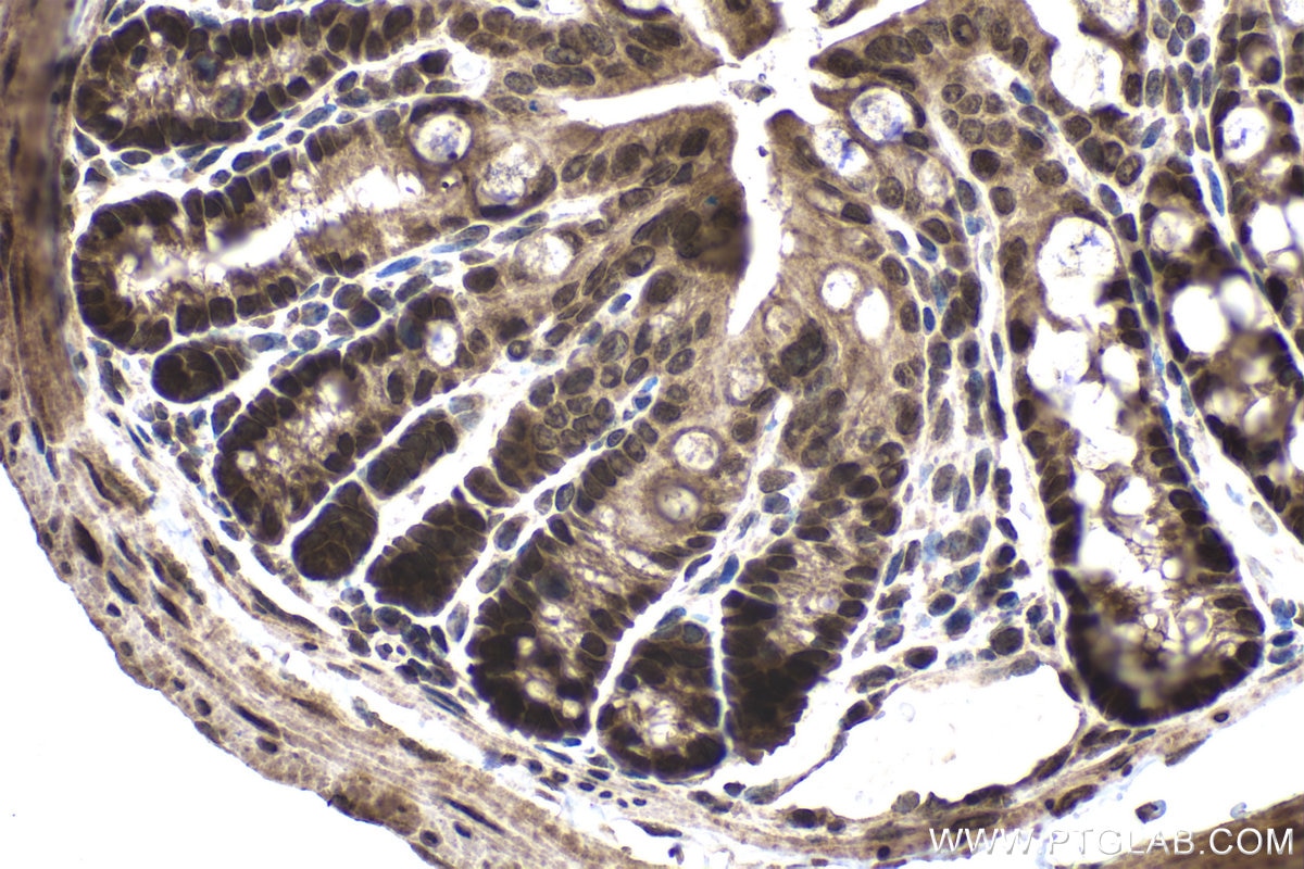 Immunohistochemistry (IHC) staining of mouse colon tissue using ATF4 Polyclonal antibody (10835-1-AP)