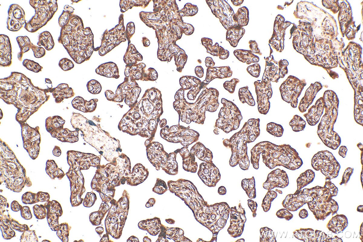 Immunohistochemistry (IHC) staining of human placenta tissue using ATF4 Polyclonal antibody (10835-1-AP)