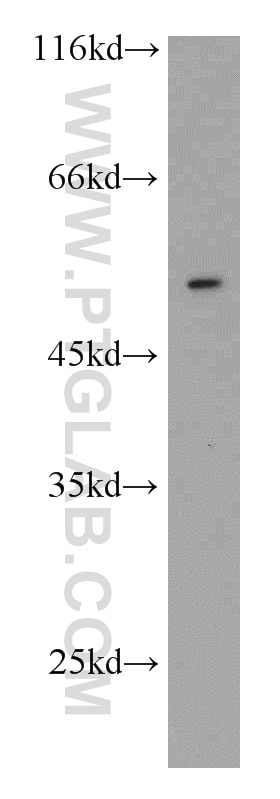 Western Blot (WB) analysis of HEK-293 cells using ATF4 Polyclonal antibody (10835-1-AP)