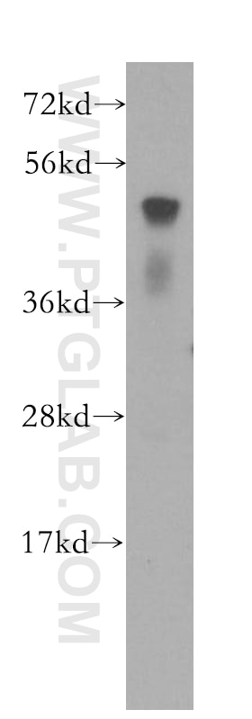 Western Blot (WB) analysis of HEK-293 cells using ATF4 Polyclonal antibody (10835-1-AP)