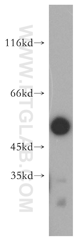 Western Blot (WB) analysis of HEK-293 cells using ATF4 Polyclonal antibody (10835-1-AP)