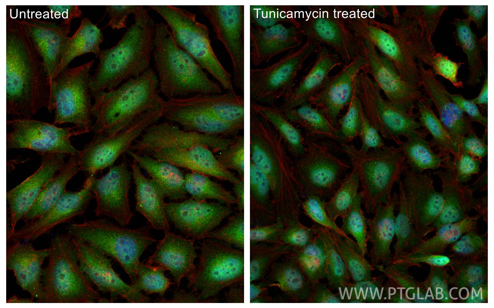 Immunofluorescence (IF) / fluorescent staining of HeLa cells using ATF4 Polyclonal antibody (28657-1-AP)