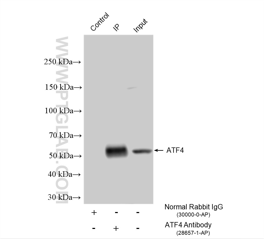 IP result of anti-ATF4 (IP:28657-1-AP, 4ug; Detection:28657-1-AP 1:2000) with A431 cells lysate 1040 ug. Immunoprecipitation (IP) experiment of A431 cells using ATF4 Polyclonal antibody (28657-1-AP)