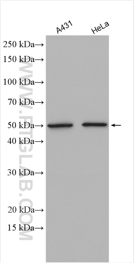 Western Blot (WB) analysis of various lysates using ATF4 Polyclonal antibody (28657-1-AP)