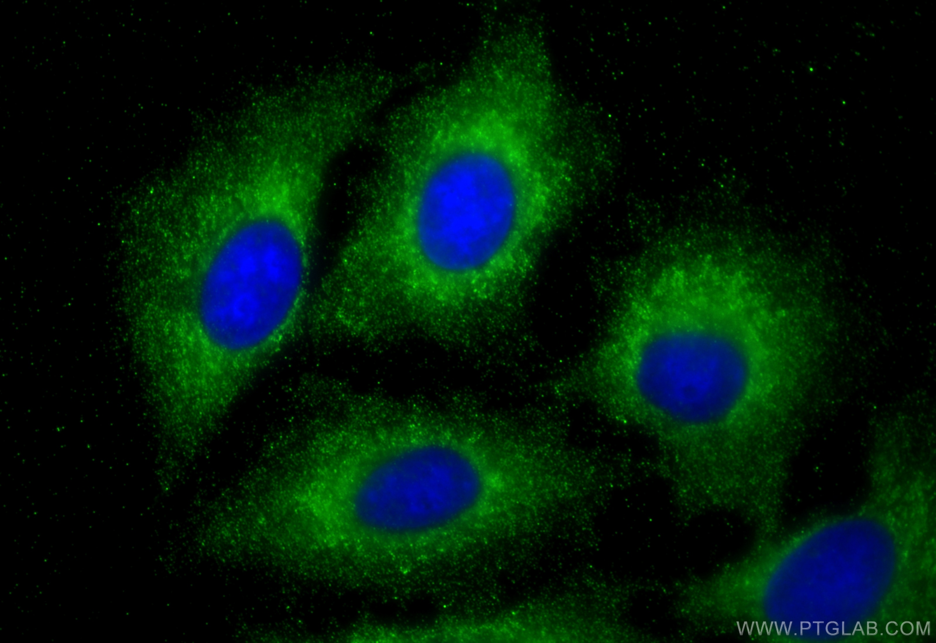 Immunofluorescence (IF) / fluorescent staining of A549 cells using ATF4 Monoclonal antibody (60035-1-Ig)