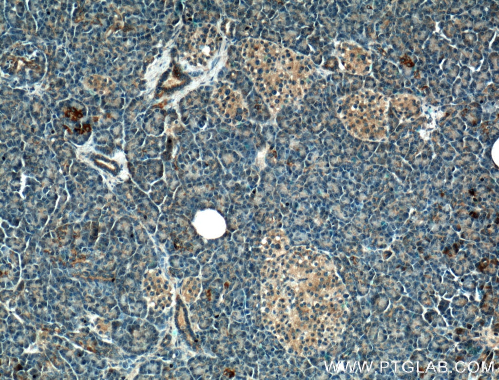 Immunohistochemistry (IHC) staining of human pancreas tissue using ATF4 Monoclonal antibody (60035-1-Ig)