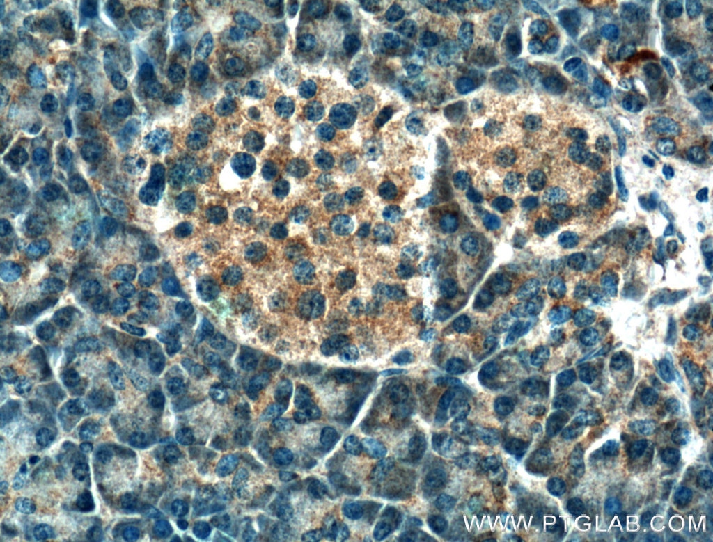 Immunohistochemistry (IHC) staining of human pancreas tissue using ATF4 Monoclonal antibody (60035-1-Ig)