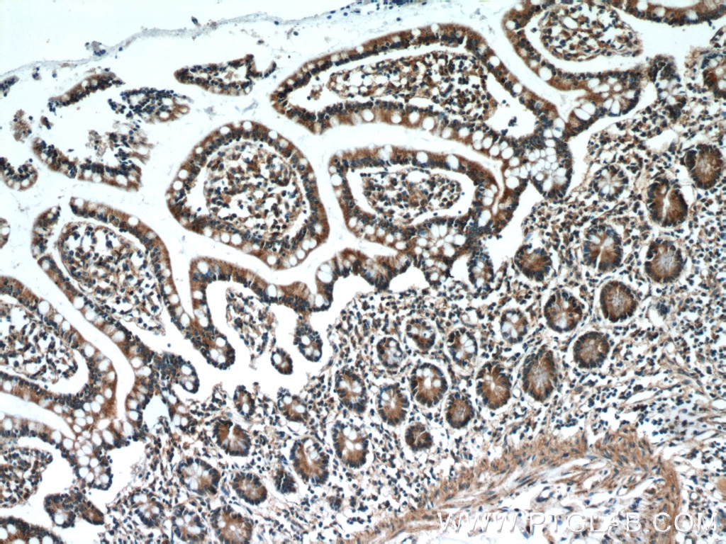 Immunohistochemistry (IHC) staining of human small intestine tissue using ATF4 Monoclonal antibody (60035-1-Ig)