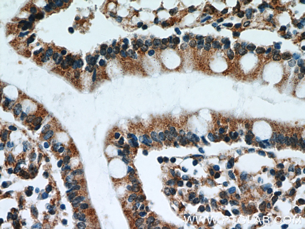 Immunohistochemistry (IHC) staining of human small intestine tissue using ATF4 Monoclonal antibody (60035-1-Ig)