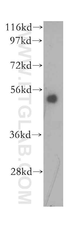 Western Blot (WB) analysis of human placenta tissue using ATF4 Monoclonal antibody (60035-1-Ig)