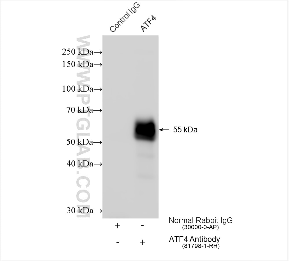 IP experiment of HEK-293 using 81798-1-RR