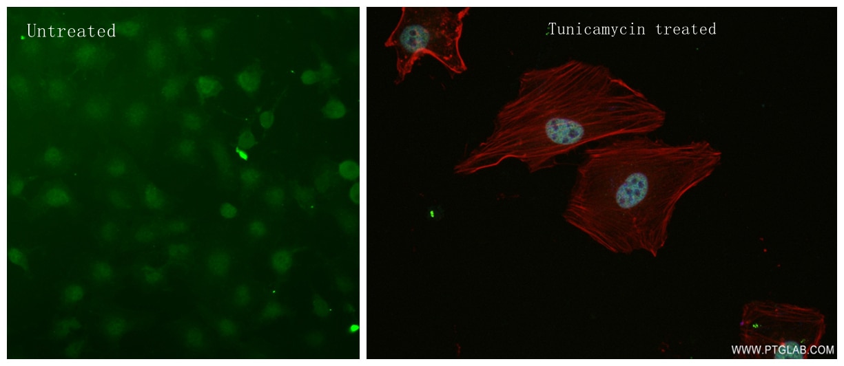 Immunofluorescence (IF) / fluorescent staining of HeLa cells using ATF4 Recombinant antibody (81798-2-RR)