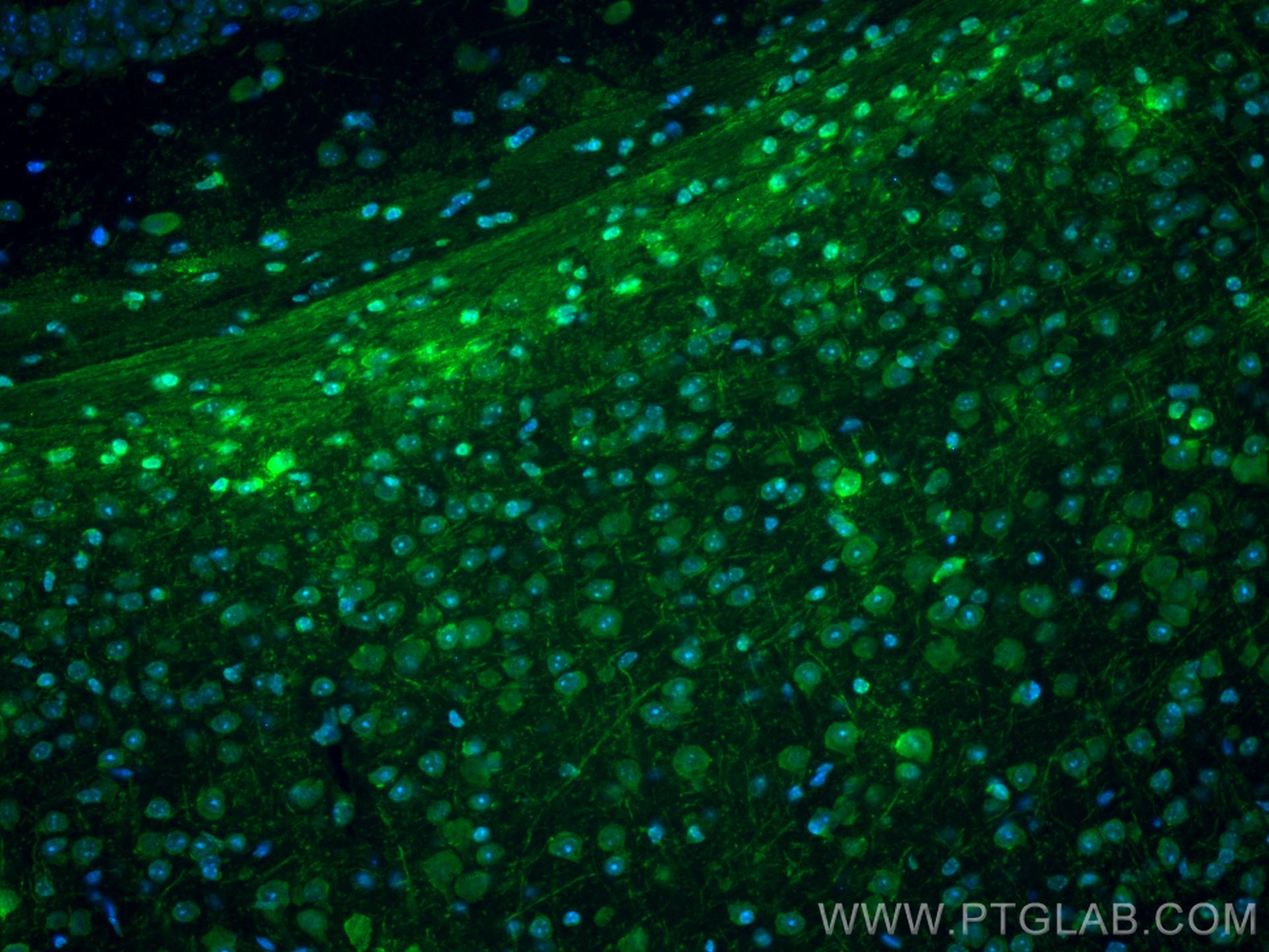 Immunofluorescence (IF) / fluorescent staining of mouse brain tissue using CoraLite® Plus 488-conjugated ATF4 Polyclonal anti (CL488-10835)