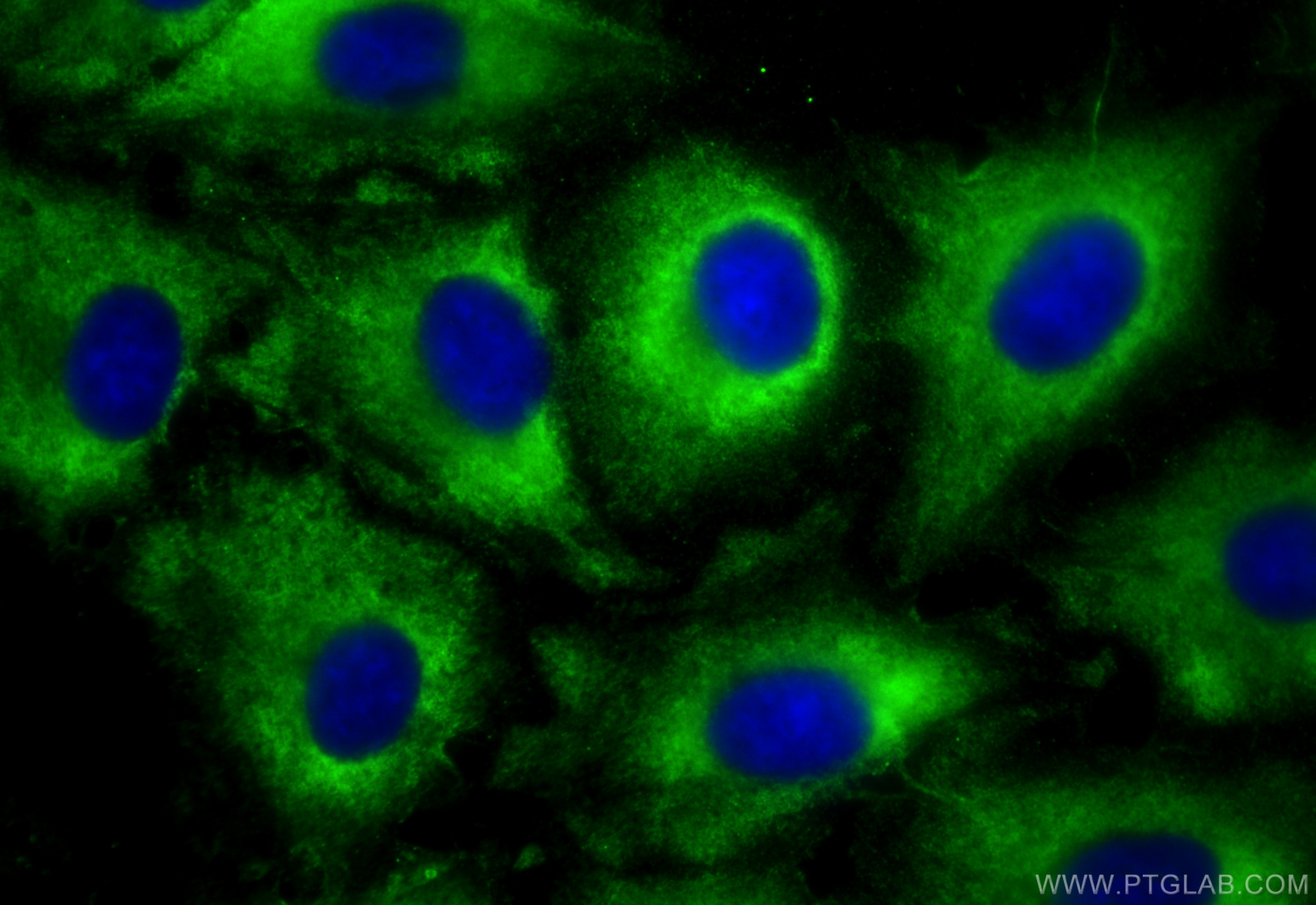 Immunofluorescence (IF) / fluorescent staining of A549 cells using CoraLite® Plus 488-conjugated ATF4 Monoclonal anti (CL488-60035)