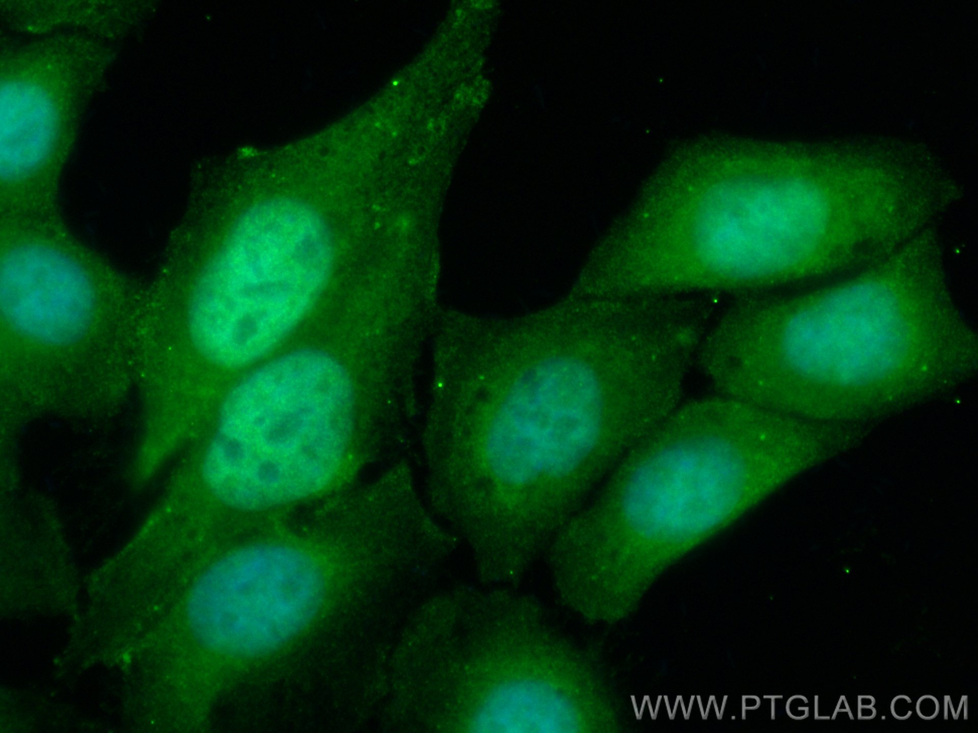 Immunofluorescence (IF) / fluorescent staining of HepG2 cells using FITC-conjugated ATF4 Polyclonal antibody (FITC-10835)