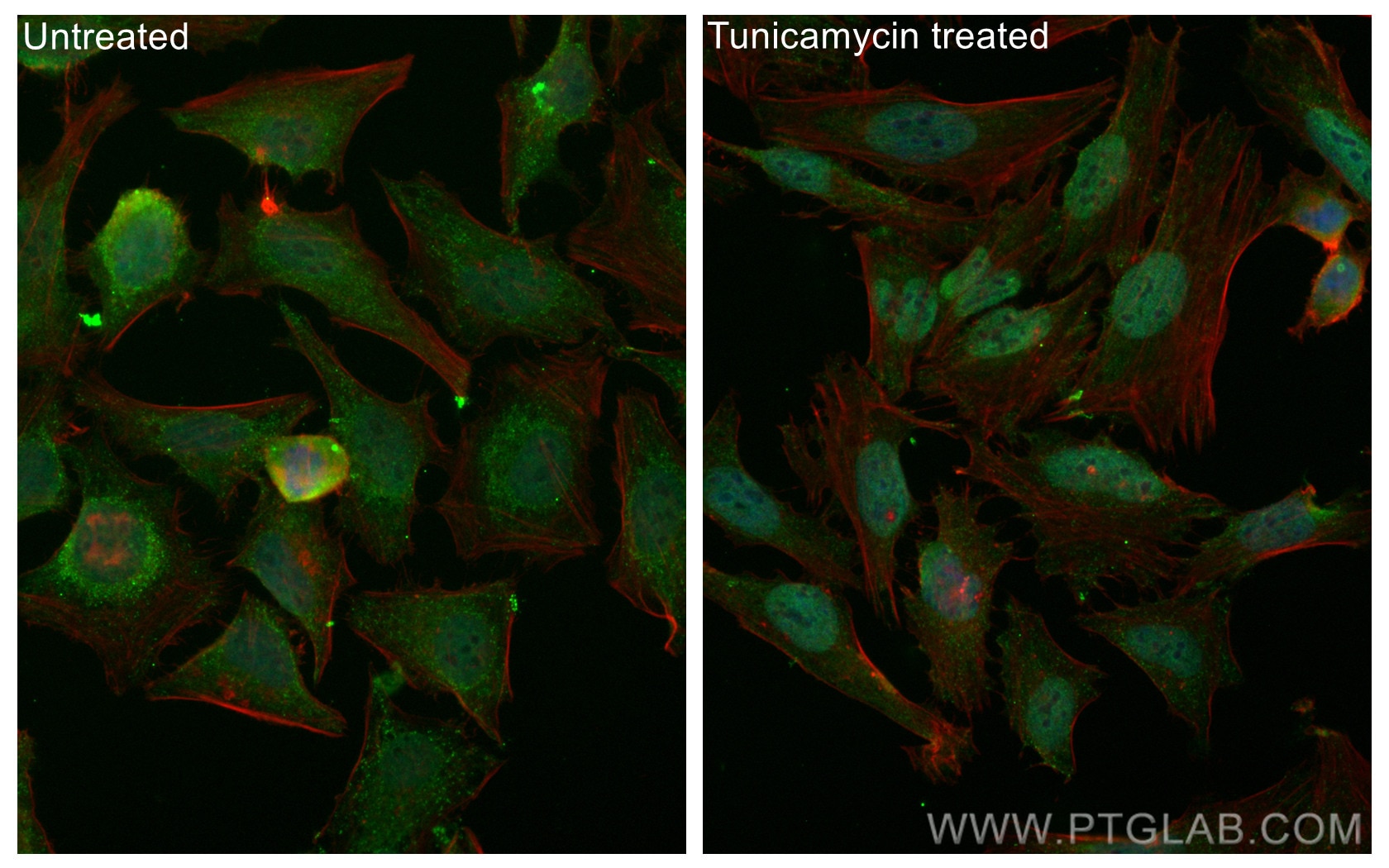 Immunofluorescence (IF) / fluorescent staining of HeLa cells using FITC-conjugated ATF4 Polyclonal antibody (FITC-10835)