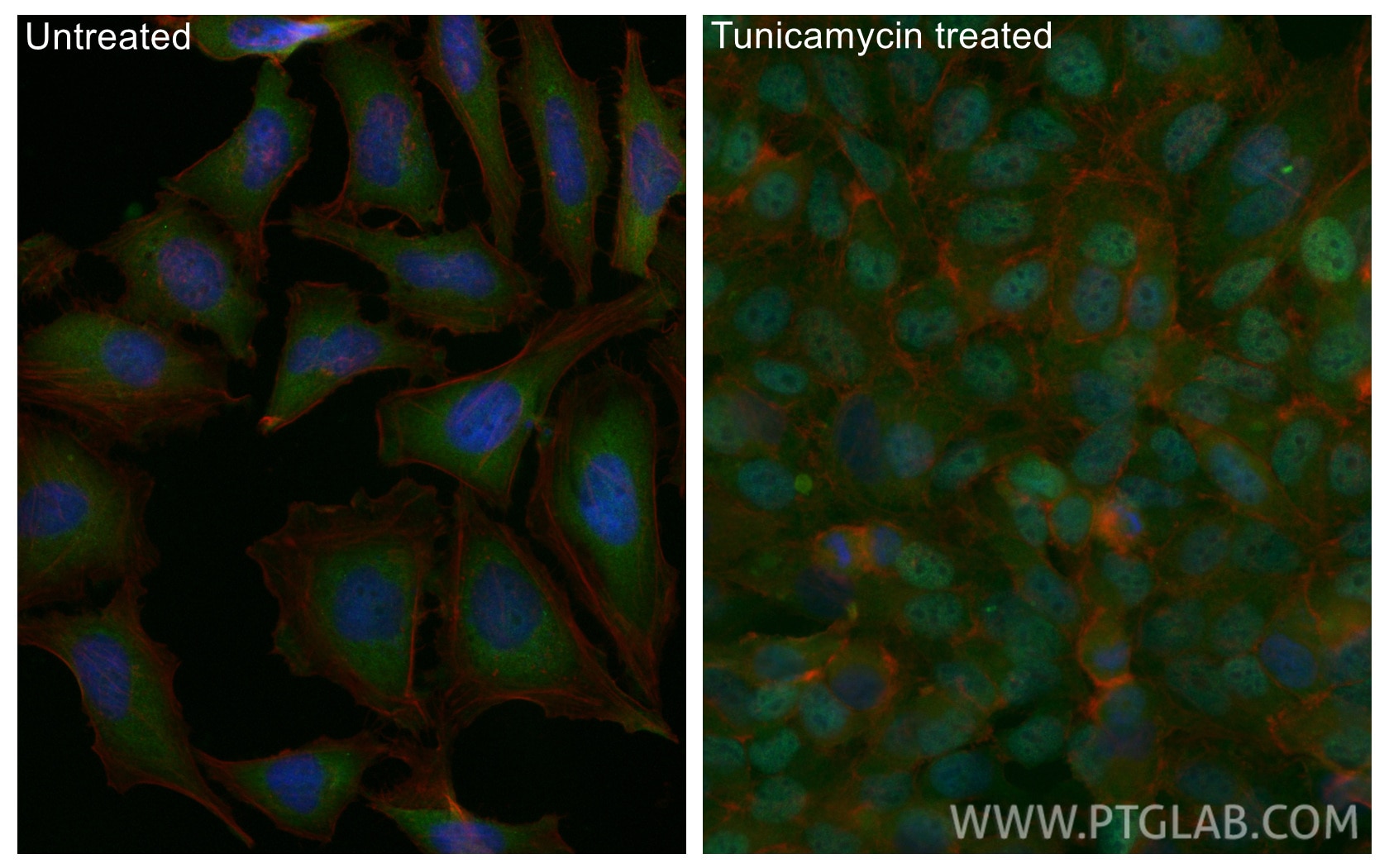 Immunofluorescence (IF) / fluorescent staining of HeLa cells using FITC-conjugated ATF4 Polyclonal antibody (FITC-10835)