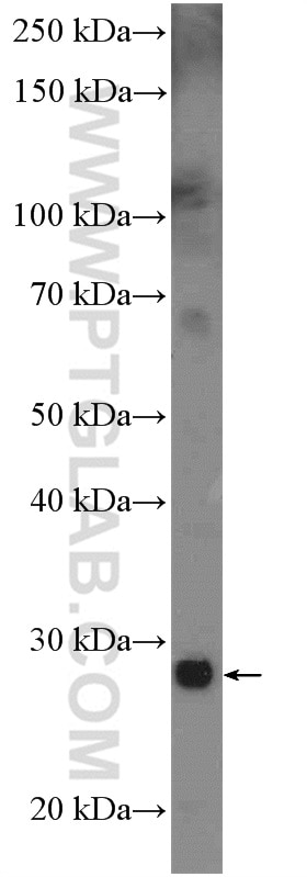 Western Blot (WB) analysis of A549 cells using ATF5 Polyclonal antibody (15260-1-AP)