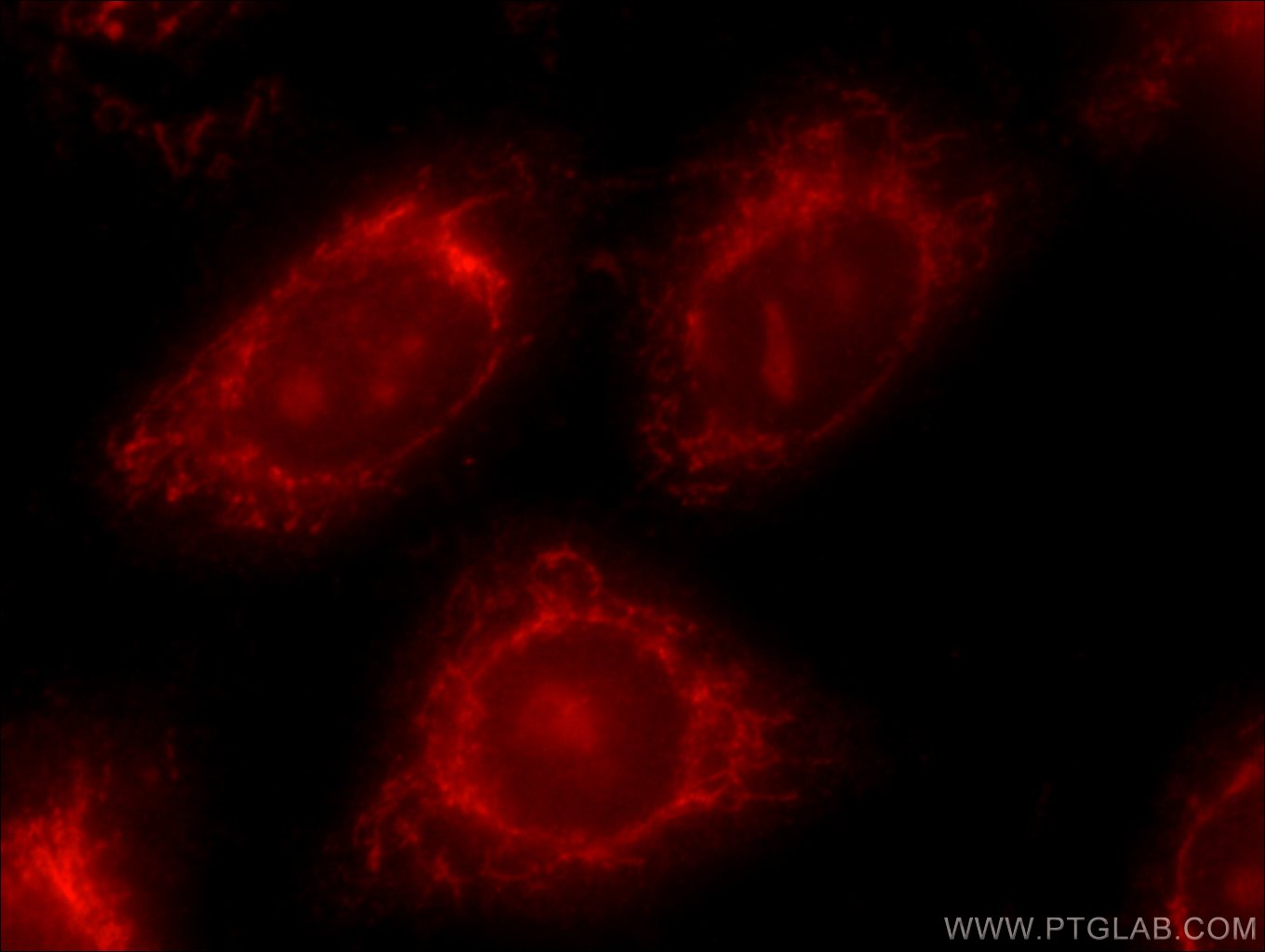 Immunofluorescence (IF) / fluorescent staining of HeLa cells using ATF6 Polyclonal antibody (24169-1-AP)