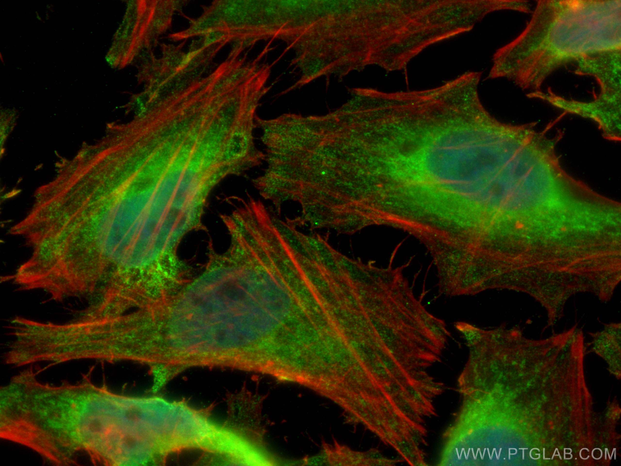 Immunofluorescence (IF) / fluorescent staining of HeLa cells using ATF6 Polyclonal antibody (24169-1-AP)