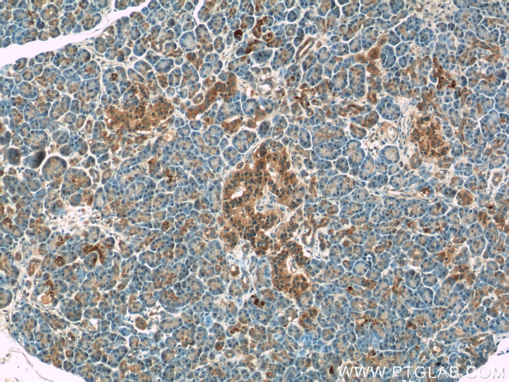 Immunohistochemistry (IHC) staining of human pancreas tissue using ATF6 Polyclonal antibody (24169-1-AP)