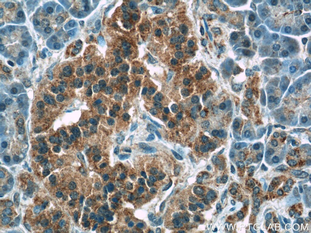 Immunohistochemistry (IHC) staining of human pancreas tissue using ATF6 Polyclonal antibody (24169-1-AP)