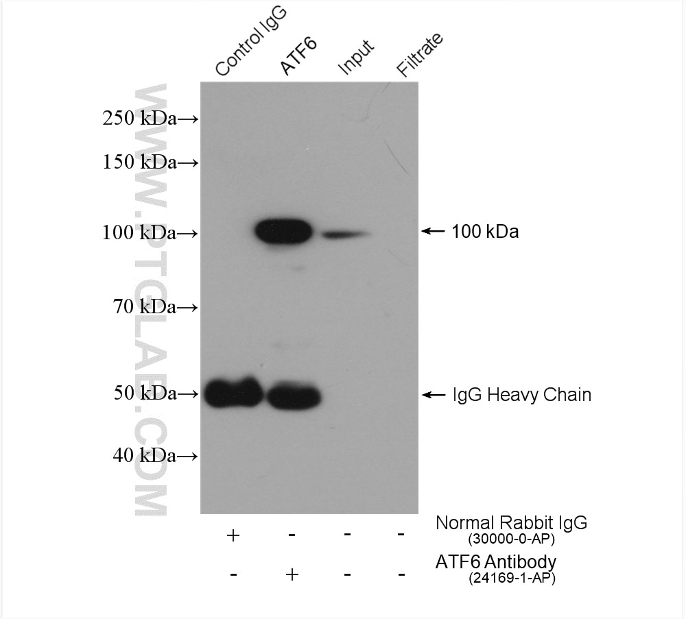 Immunoprecipitation (IP) experiment of HeLa cells using ATF6 Polyclonal antibody (24169-1-AP)