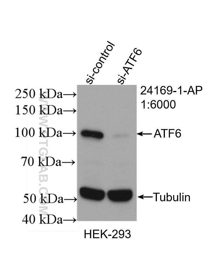 Western Blot (WB) analysis of HEK-293 cells using ATF6 Polyclonal antibody (24169-1-AP)