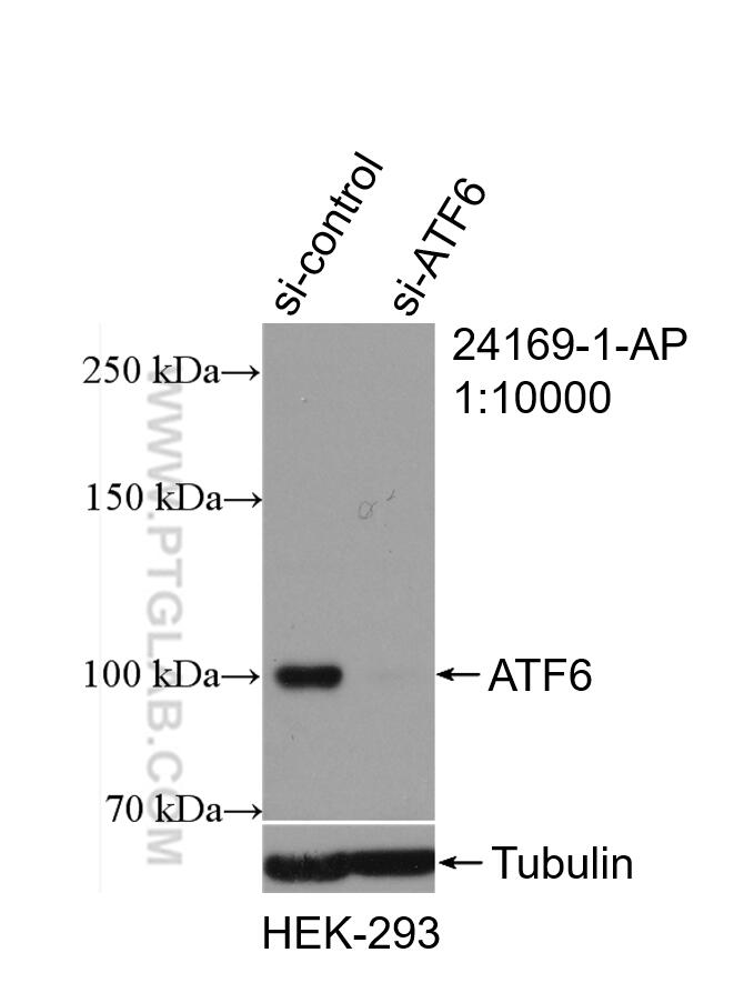 Western Blot (WB) analysis of HEK-293 cells using ATF6 Polyclonal antibody (24169-1-AP)