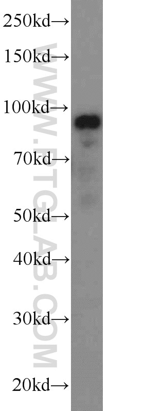 Western Blot (WB) analysis of HeLa cells using ATF6 Polyclonal antibody (24169-1-AP)