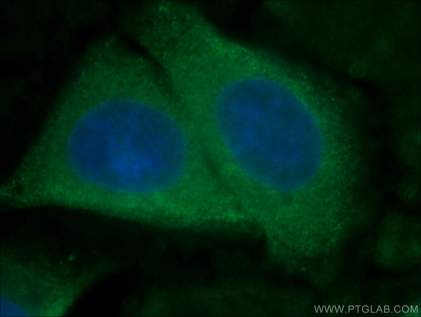 Immunofluorescence (IF) / fluorescent staining of HepG2 cells using ATF6 Monoclonal antibody (66563-1-Ig)