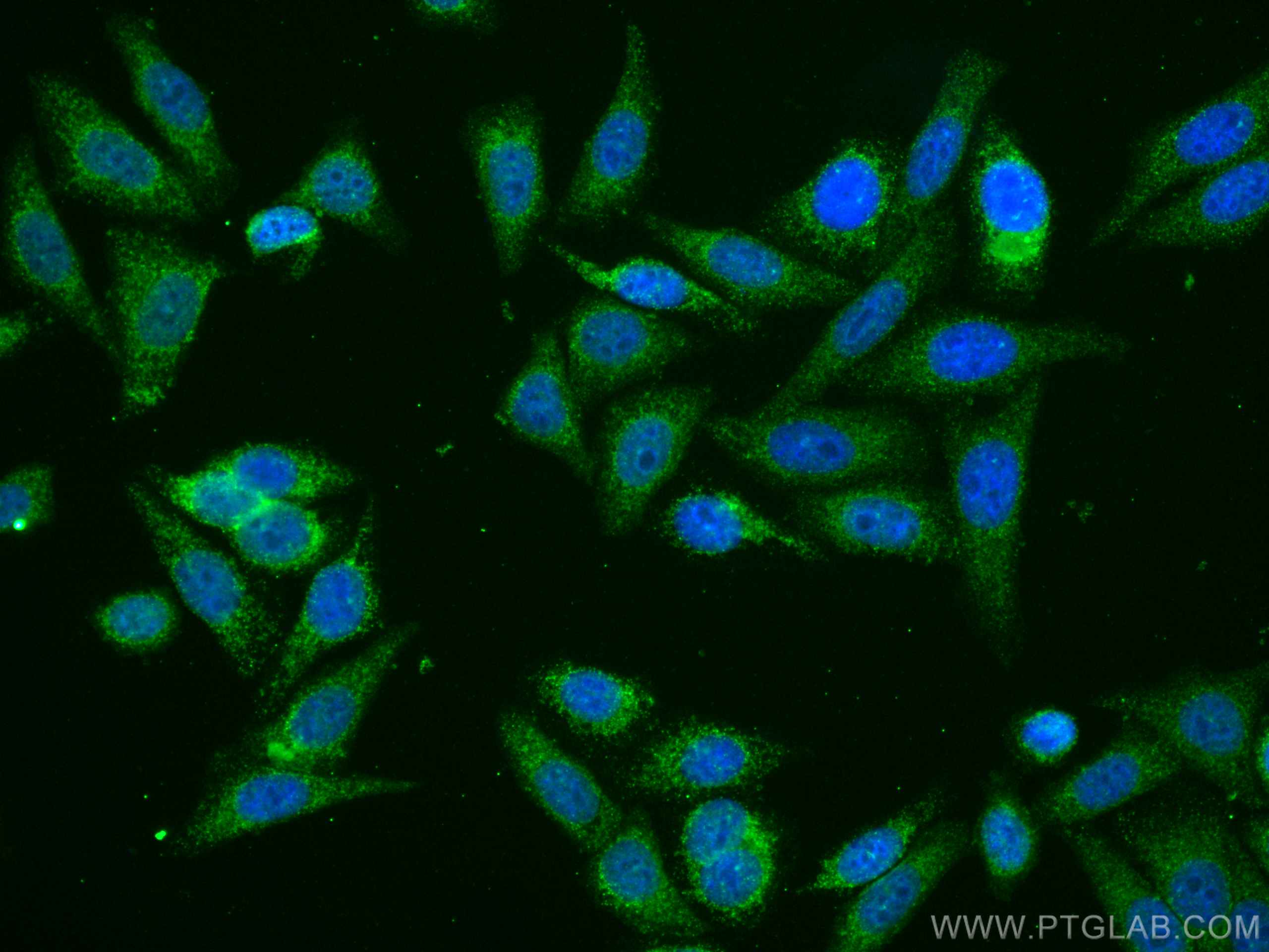 Immunofluorescence (IF) / fluorescent staining of HepG2 cells using CoraLite® Plus 488-conjugated ATF6 Monoclonal anti (CL488-66563)