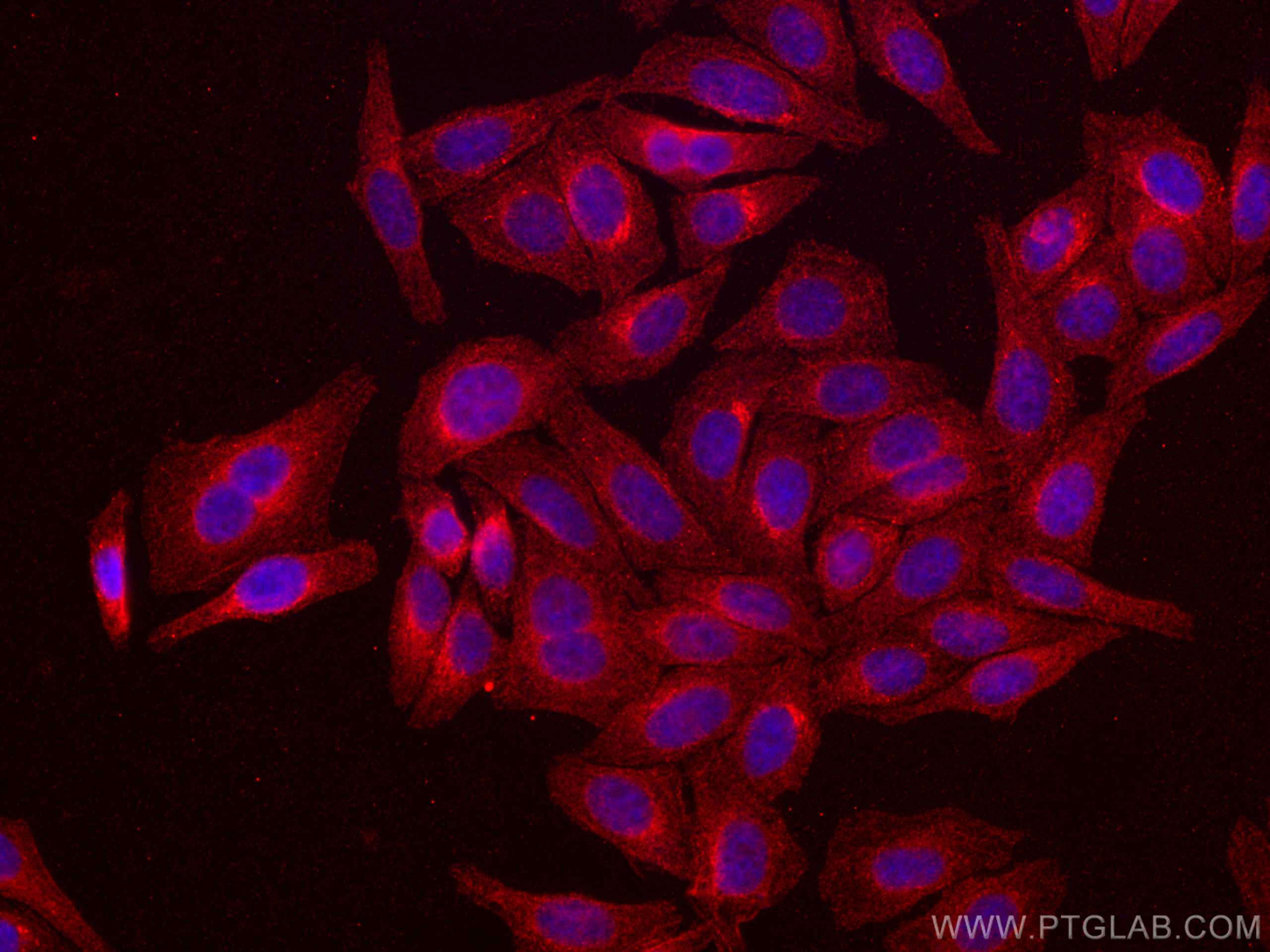 Immunofluorescence (IF) / fluorescent staining of HepG2 cells using CoraLite®594-conjugated ATF6 Monoclonal antibody (CL594-66563)